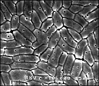 Ionsko koloidno nano srebro ubija Escherichiu Coli